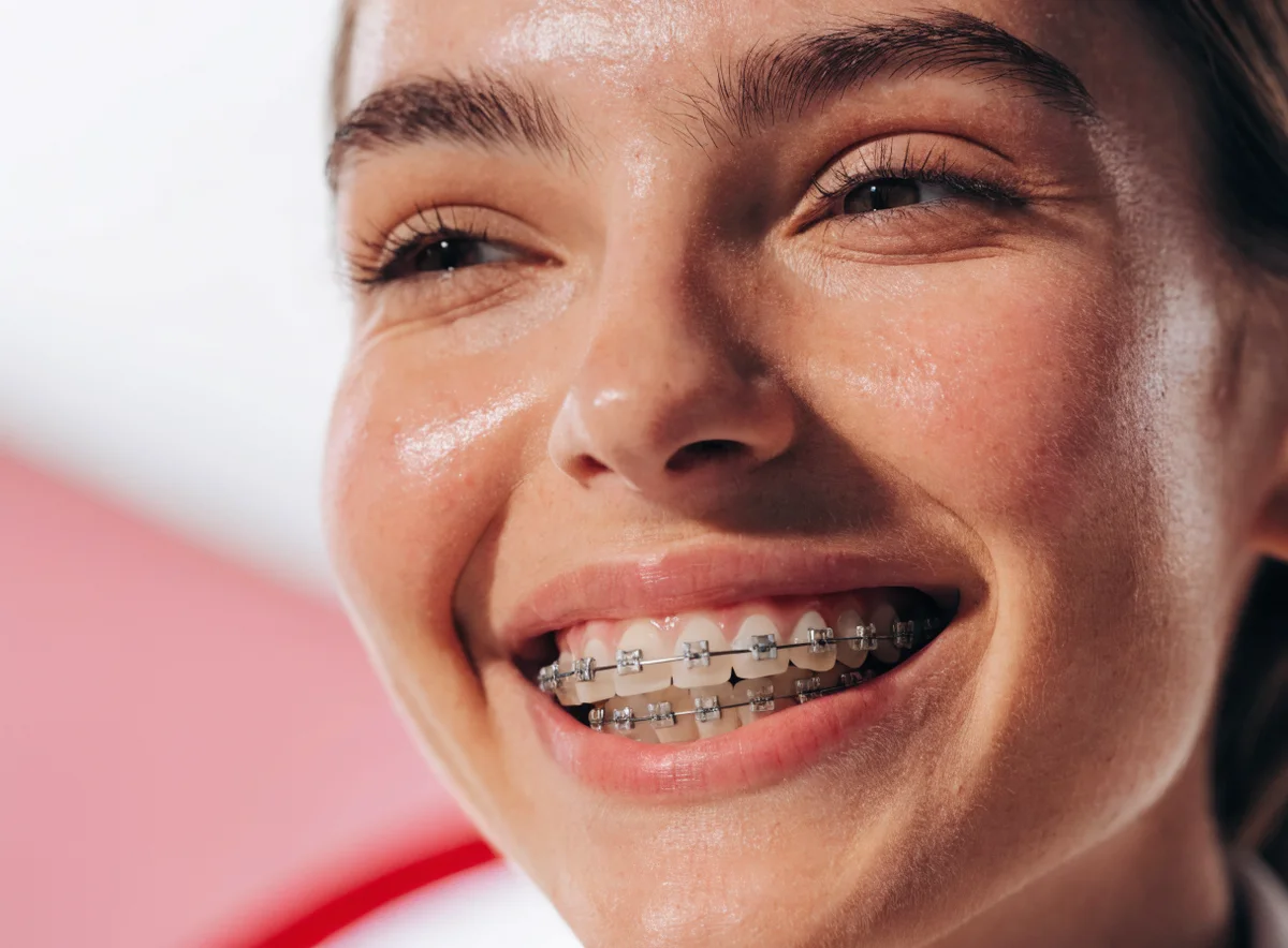 Braces treatment at Plux Dental, Taman Melawati (illustrative)