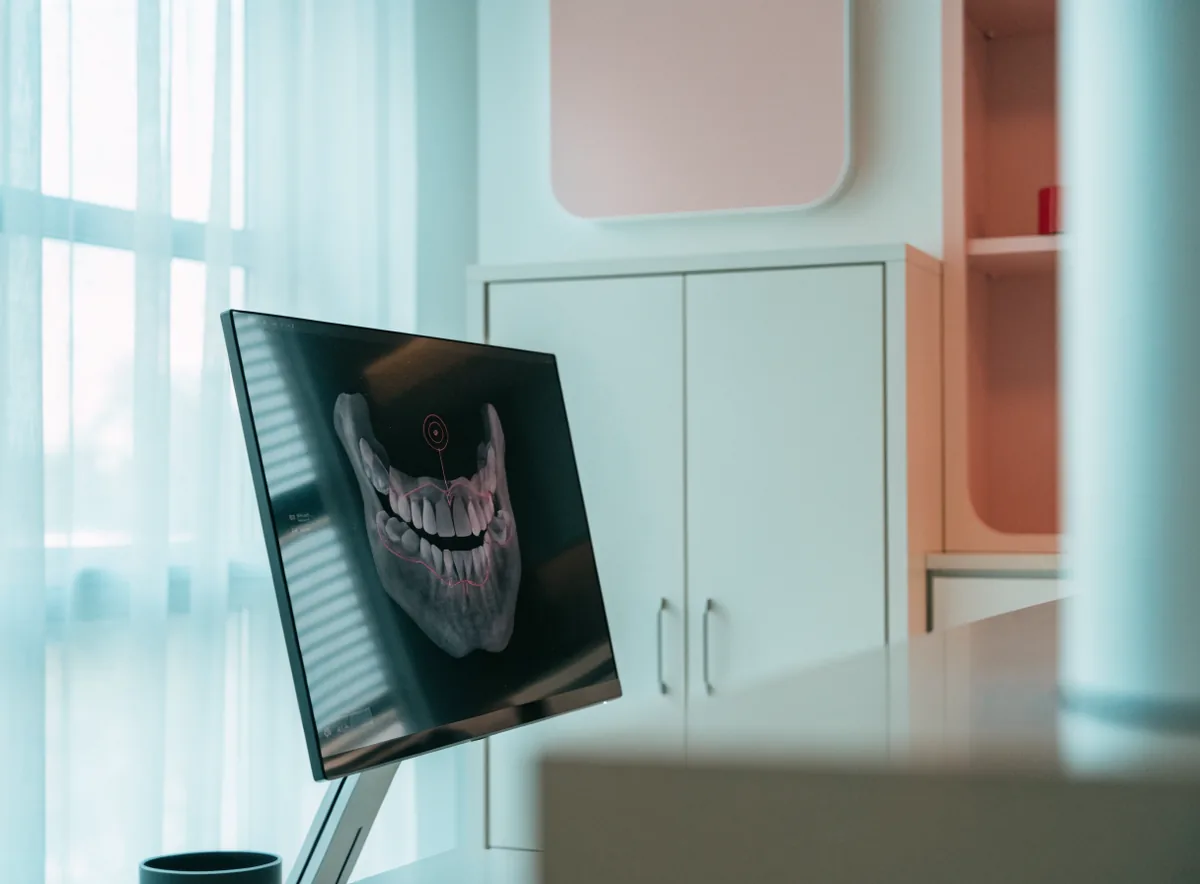 Three-dimensional jaw scan on a planning monitor (illustrative)