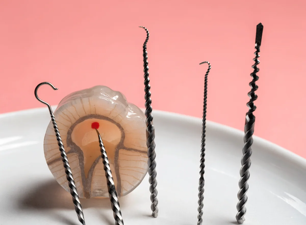 Root canal treatment at Plux Dental, Taman Melawati (illustrative)