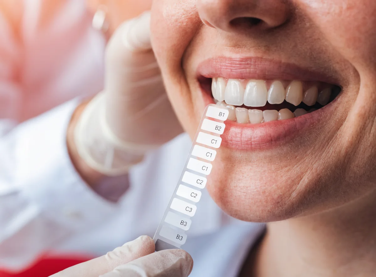 Teeth whitening at Plux Dental, Taman Melawati (illustrative)